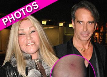 //jocelyn wildenstein fall date