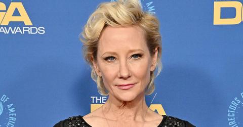 anne heche hospitalized burned fire car crash