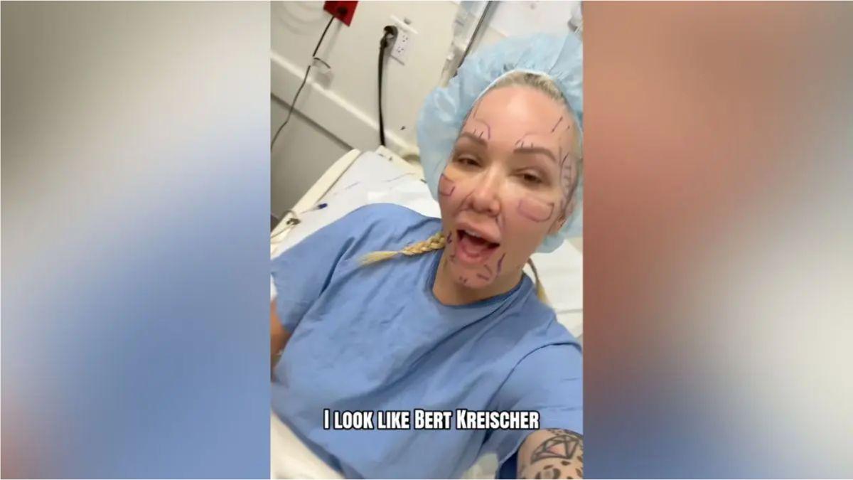 image of The podcast host showed heavy swelling and bandages in the immediate aftermath.