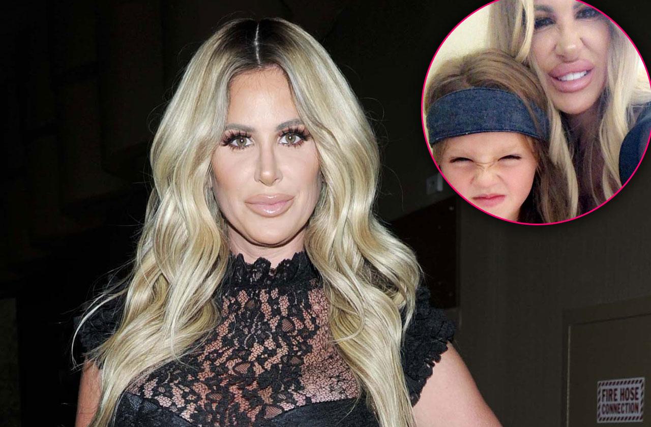 Kim Zolciak Slammed Plastic Face Lip Fillers