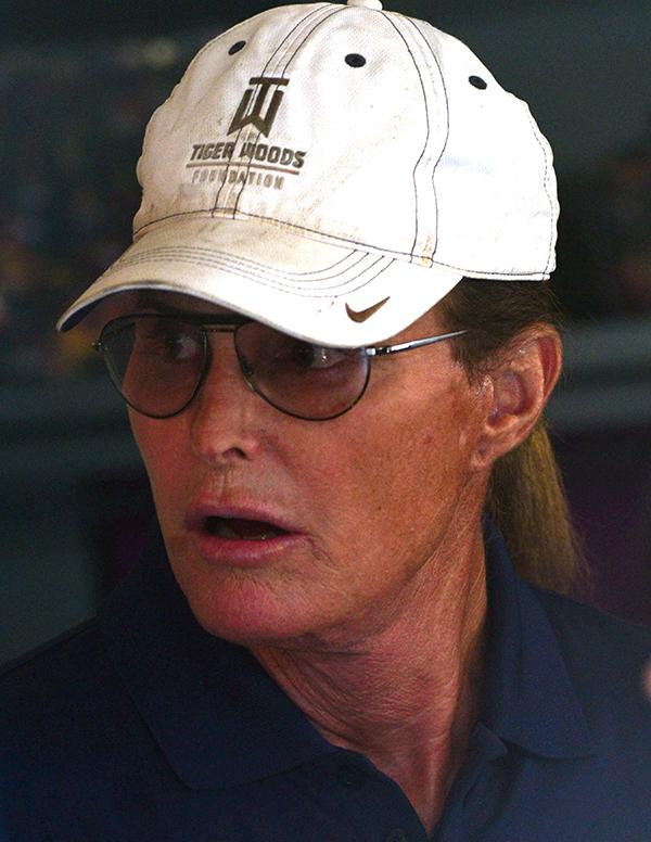 //bruce jenner sex change doctor estimates  transformation