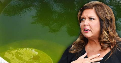 abby lee miller dirty pool mosquitoes rats photos dance moms