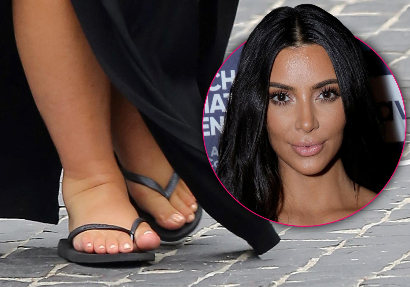 kim kardashian swollen feet cankles hammer toe surgery