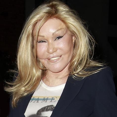 Catwoman Jocelyn Wildenstein Avoids Eviction From Luxury NYC Apartment