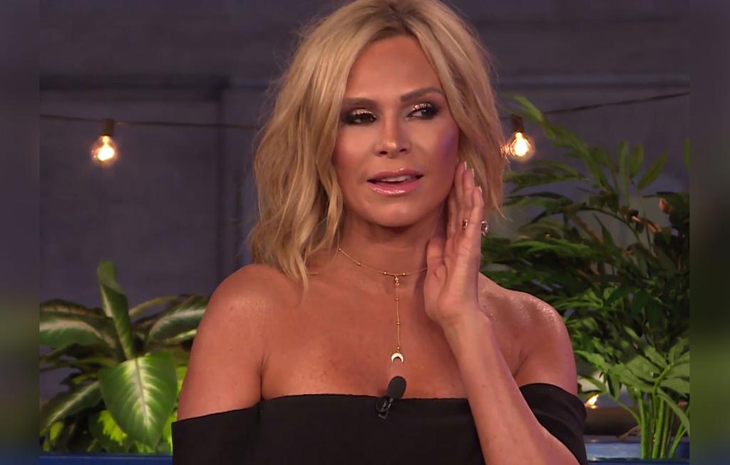 [PICS] Tamra Judge's Plastic Surgery Confession!