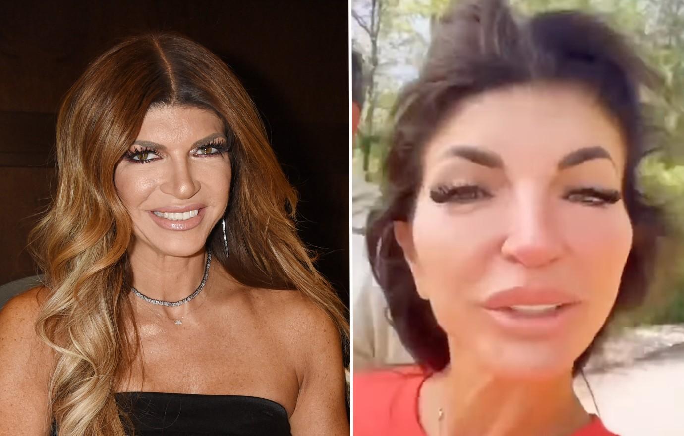 Teresa Giudice Looks Unrecognizable as Doctors Reveal What Plastic Surgery Caused Shocking New Look photo photo