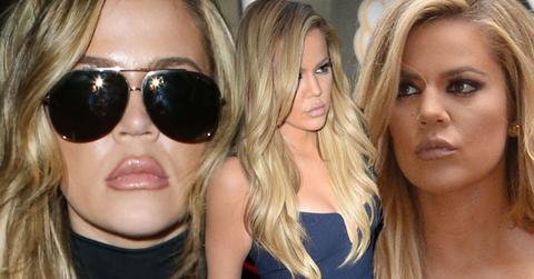 //khloe kardashian plastic surgery doctor