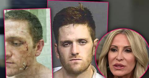 Josh Waring Mugshot Josh Waring Scars stitches inst Lari Peterson