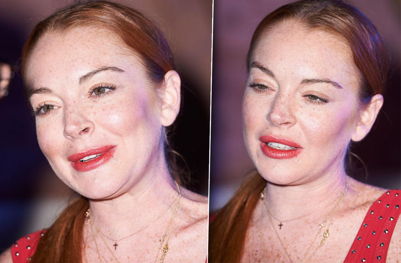 Lindsay Lohan Face Plastic Surgery