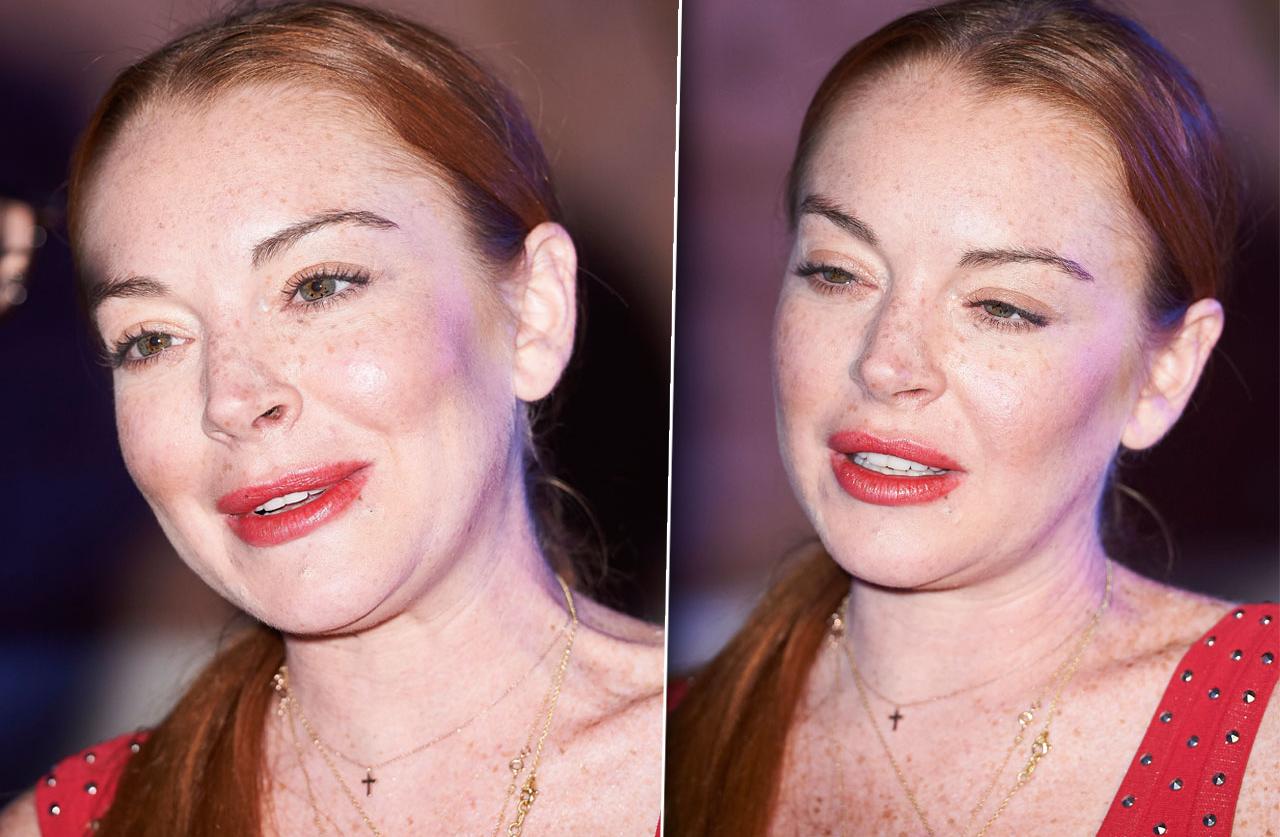 Lindsay Lohan's Face Looks Bizarre Amid Plastic Surgery Rumors