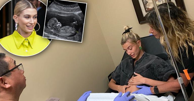 Justin Bieber Declares Hailey Baldwin's Pregnant