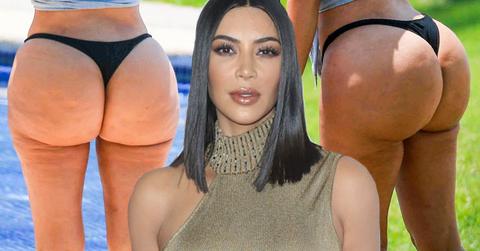 Kim Kardashian Butt Implants Plastic Surgery Doctor