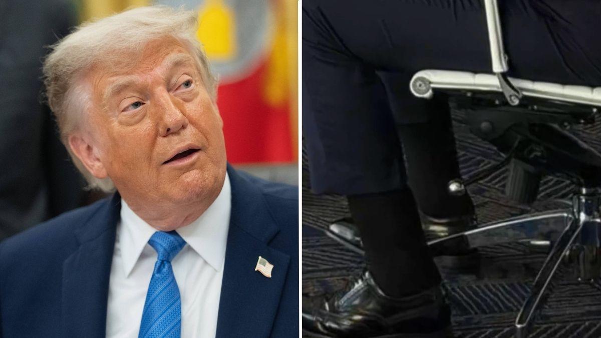 Photo of Donald Trump, Donald Trump ankles