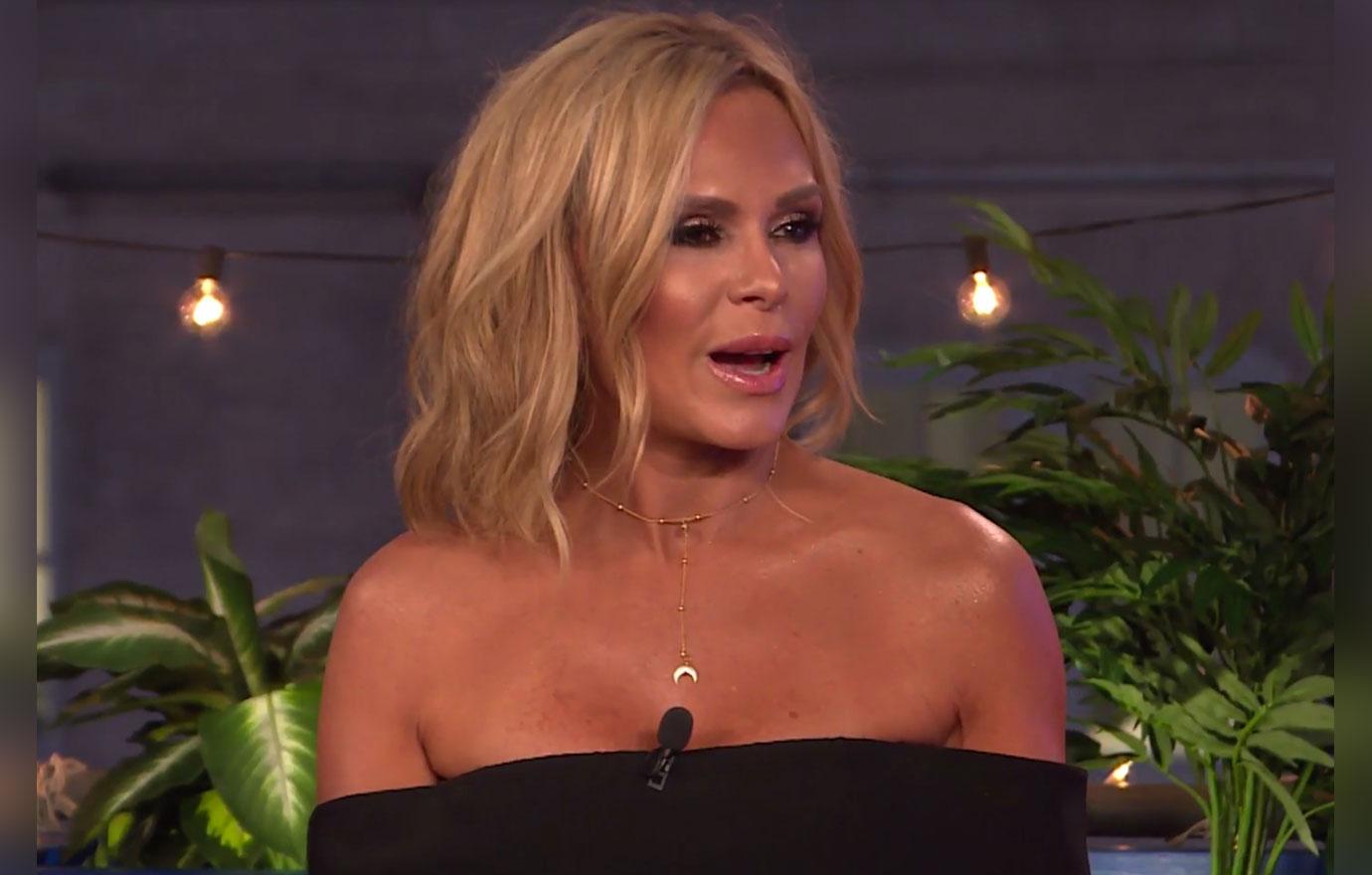 tamra judge plastic surgery face lift rhoc wwhl pics