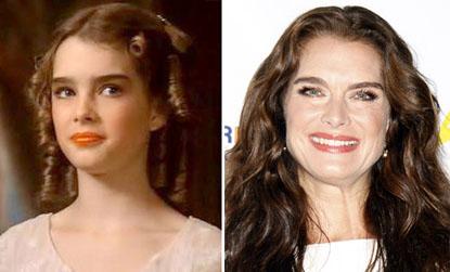 //brooke shields child star plastic surgery
