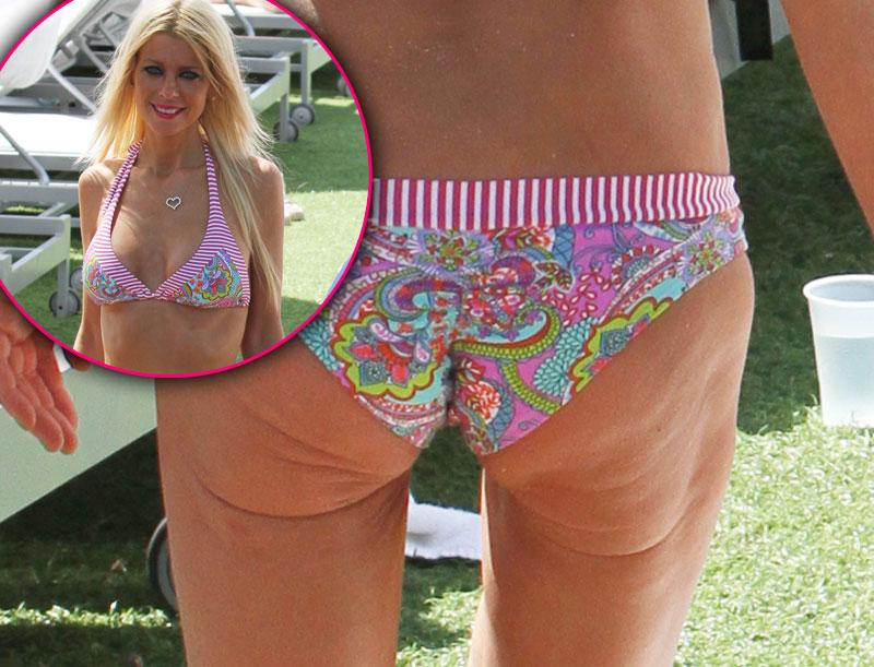 extreme celebrity body flaws