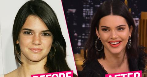//Kendall Jenner Plastic Surgery pp