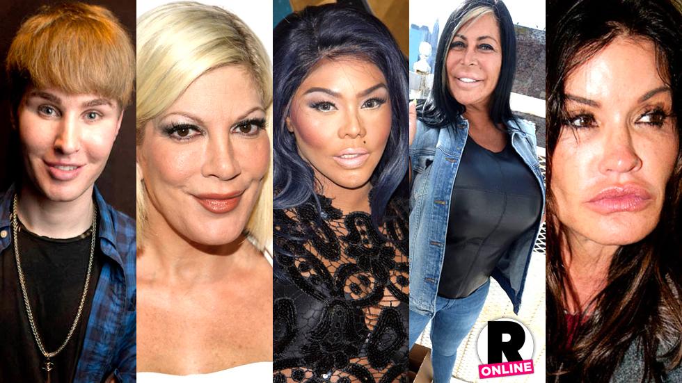 From Madonna to Big Ang to Tori Spelling, top doctors dish on who has had t...