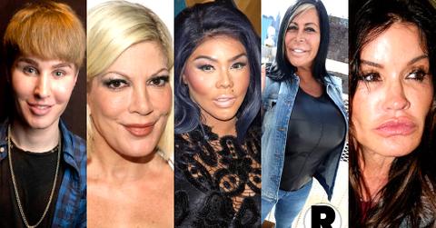 Plastic Surgery Shockers