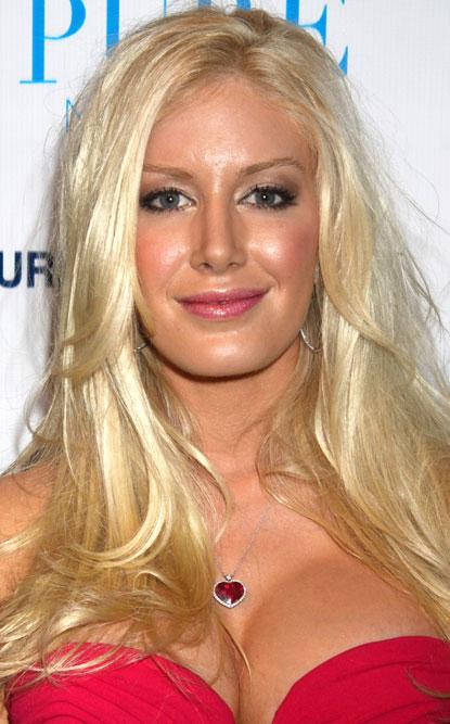 //heidi montag chipmunk cheeks