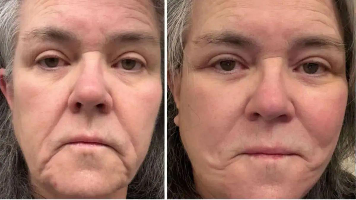 image of The actress also revealed she recently underwent a deep-plane facelift after losing over 50 pounds.