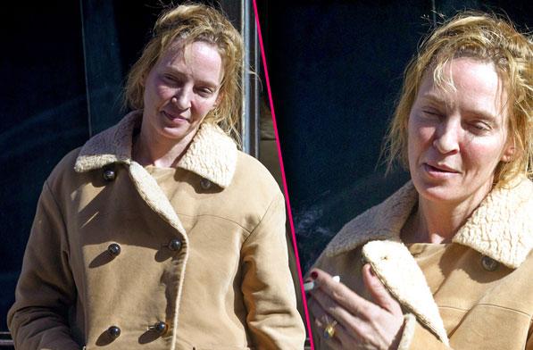 uma thurman plastic surgery 2022