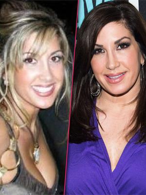 //jacqueline laurita before after plastic surgery breasts face tall