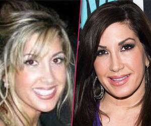 //jacqueline laurita before after plastic surgery breasts face tall