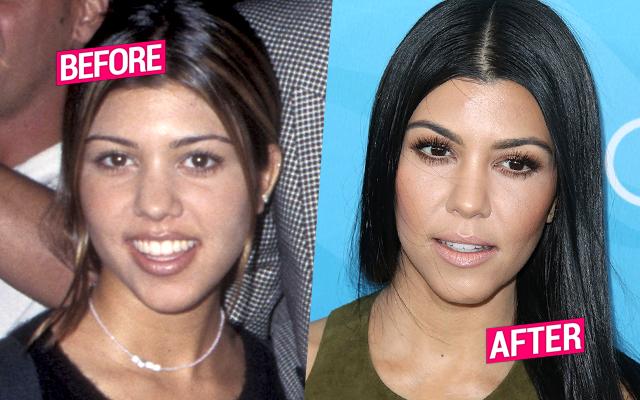 kourtney kardashian before and after