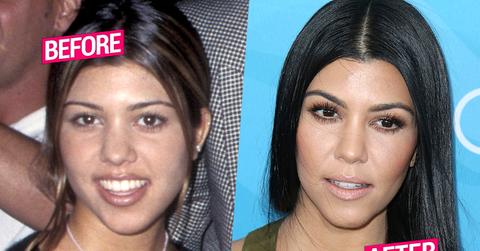 Kourtney Kardashian Plastic Surgery