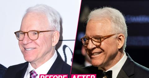 Laugh Lines? Leading Plastic Surgeons Break Down Comedian Steve Martin’s Secrets To His Youthful Look at 74