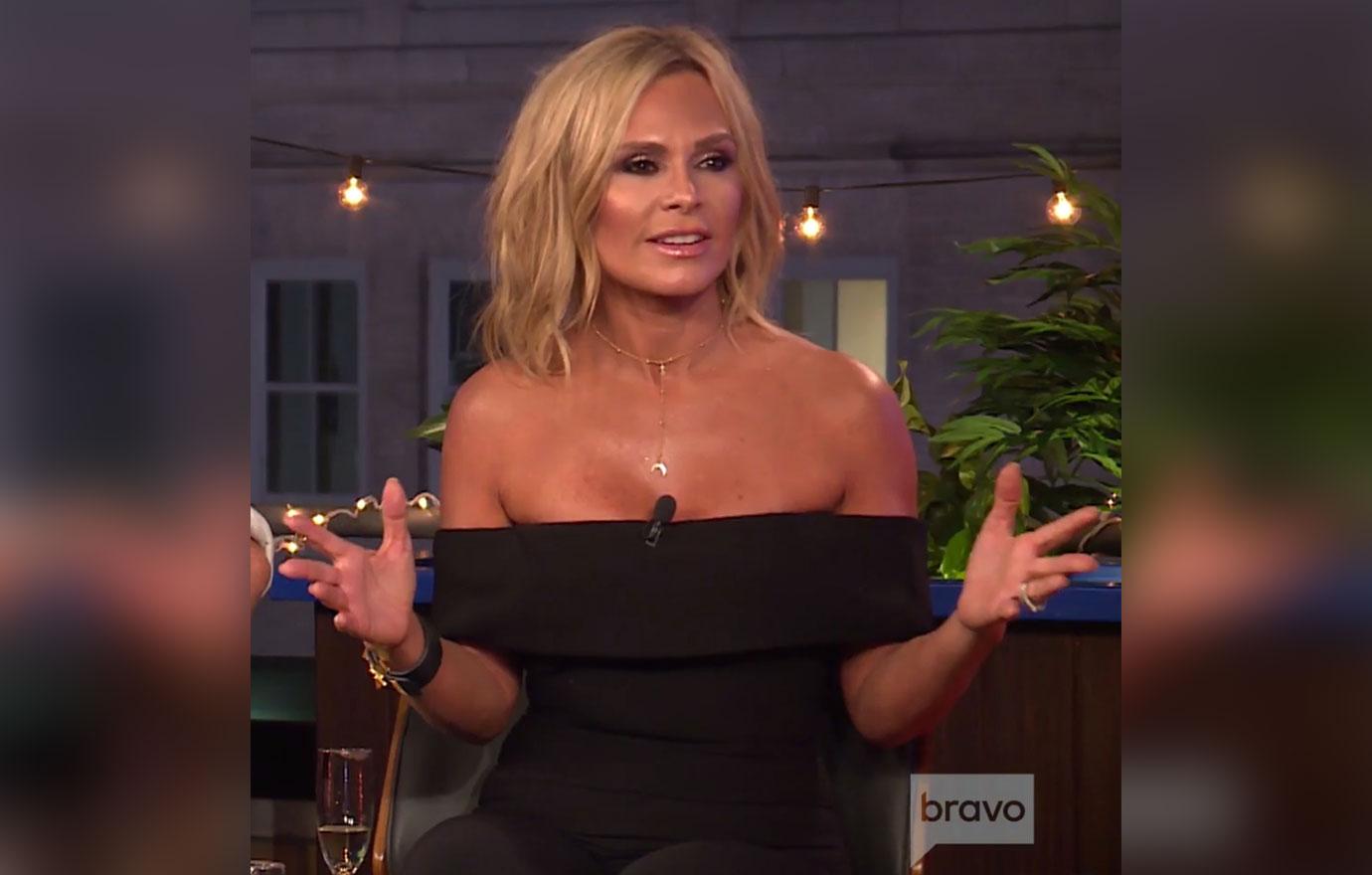 tamra judge plastic surgery face lift rhoc wwhl pics