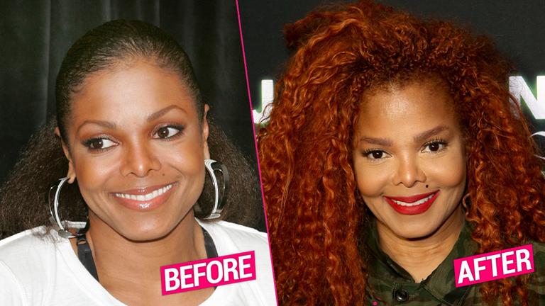 Janet Jackson Shocking Plastic Surgery Makeover Revealed