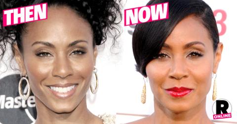 Jada Pinkett Smith Plastic Surgery Botox Fillers
