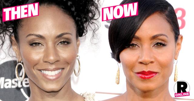 Flawless At 43 Top Doc Says Jada Pinkett Smith Owes Her Fresh Face To