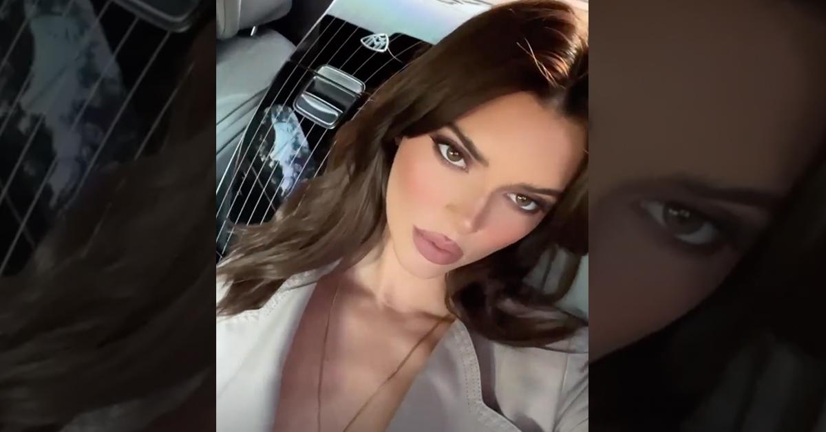 kendall jenner bad lip injections plastic surgery filler