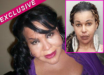 //raj narinesingh cement injections