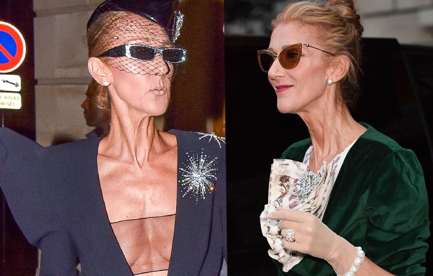 Scary Skinny Celine Dion Approves Two Life Biopics