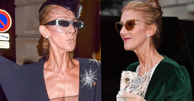 Scary Skinny Celine Dion Approves Two Life Biopics