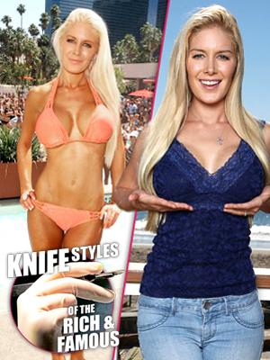 Heidi Montag Shows Off New F-Cup Boobs in Public Las Vegas Photoshoot!