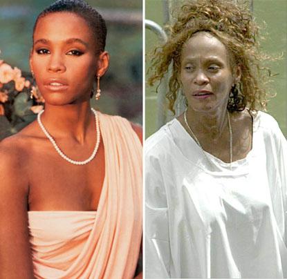 Just Say No To Drugs! The Most Shocking Celebrity Transformations