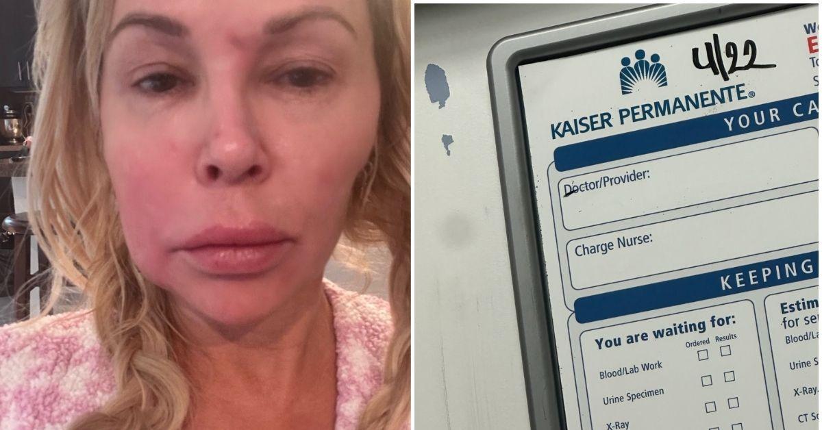 Brandi Glanville Rushed To Hospital Amid 'Parasite' Facial Battle