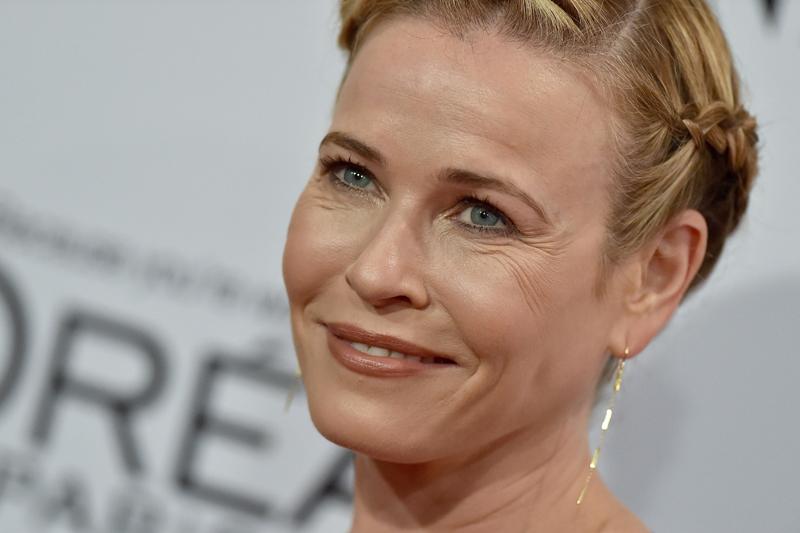 Had A Facelift, Lately?! Chelsea Handler's Frozen Face EXPOSED — Before ...