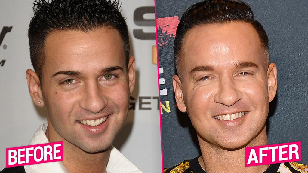 'Jersey Shore' Cast's Shocking Plastic Surgery Transformations Revealed