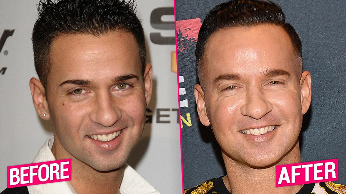 'Jersey Shore' Cast's Shocking Plastic Surgery Transformations Revealed
