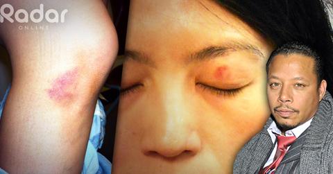 //t howard bruise woman wide_