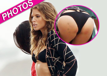 //annalynne mccord bruise bikini