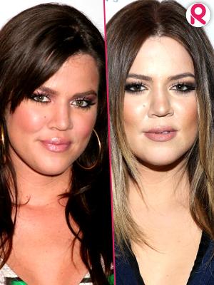 //khloe kardashian facial changes through the years tall