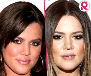 //khloe kardashian facial changes through the years tall