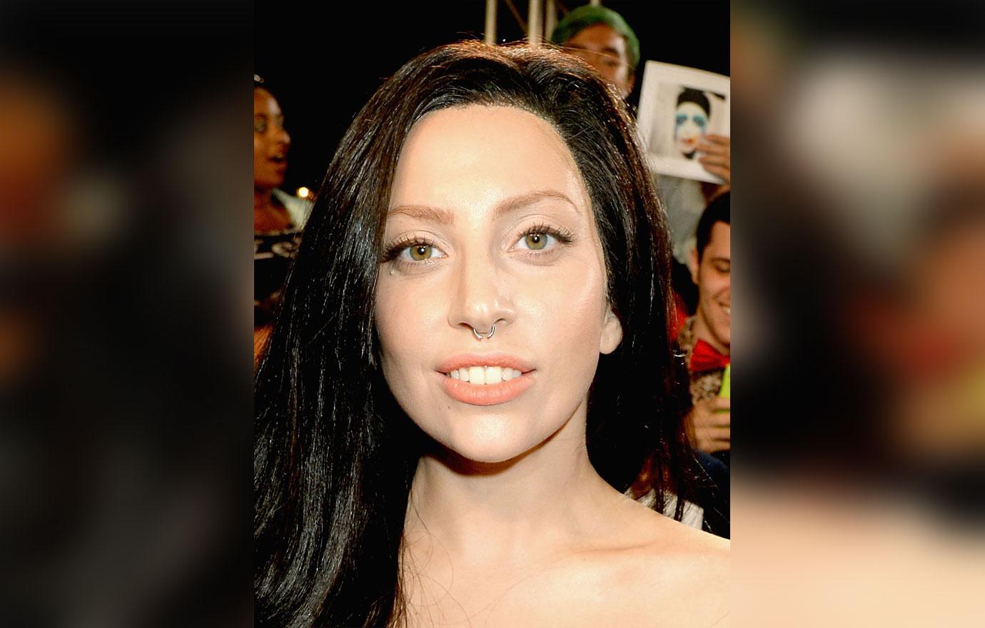 Lady Gaga Plastic Surgery